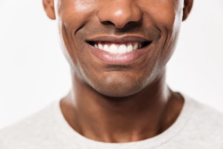 Professional Teeth Whitening: All The Information You Need