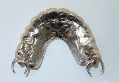 Metal occlusal design which will prevent the teeth from breaking off the frame and provide long term durability