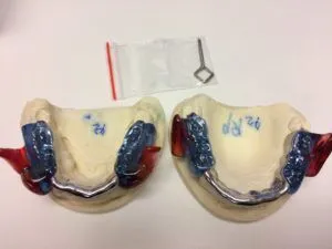 Respire Medical Appliance for Sleep Apnea and Snoring