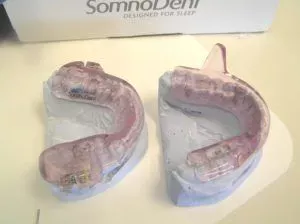 SomnoMed Appliance for Sleep Apnea and Snoring